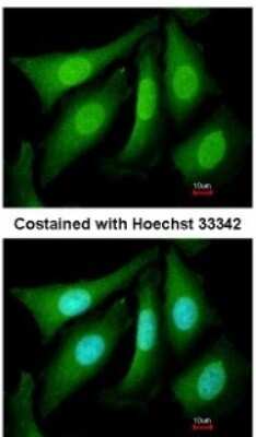 Immunocytochemistry/ Immunofluorescence: SUG1 Antibody [NBP2-20529]