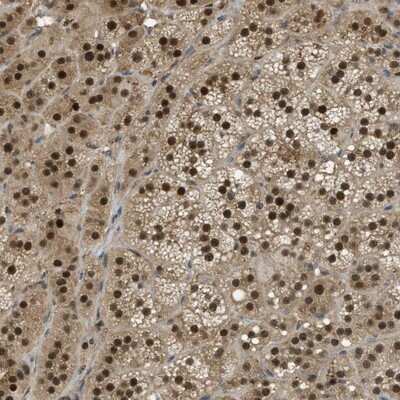 Immunohistochemistry-Paraffin: SUG1 Antibody [NBP1-87372]