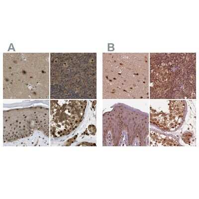 Immunohistochemistry-Paraffin: SUG1 Antibody [NBP1-87372]