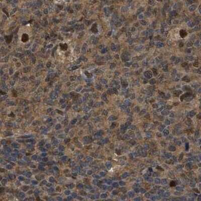 Immunohistochemistry-Paraffin: SUG1 Antibody [NBP1-87372]