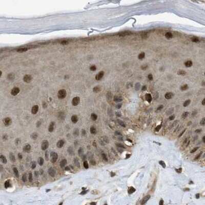 Immunohistochemistry-Paraffin: SUG1 Antibody [NBP1-87372]