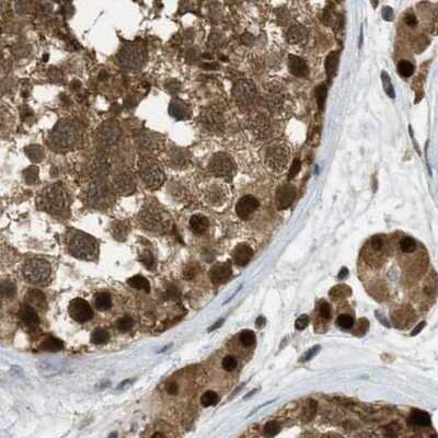 Immunohistochemistry-Paraffin: SUG1 Antibody [NBP1-87372]