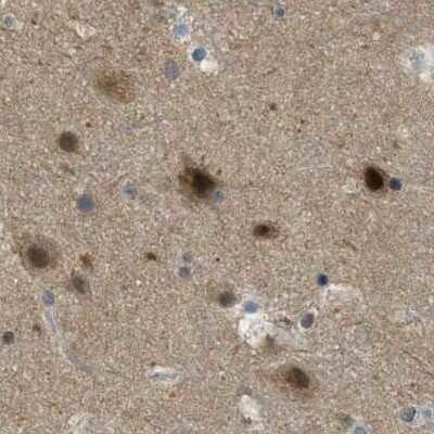 Immunohistochemistry-Paraffin: SUG1 Antibody [NBP1-87372]