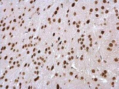 Immunohistochemistry-Paraffin: SUG1 Antibody [NBP2-20529]
