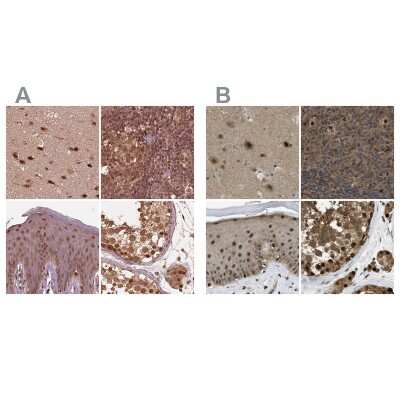 Immunohistochemistry-Paraffin: SUG1 Antibody [NBP2-57621]