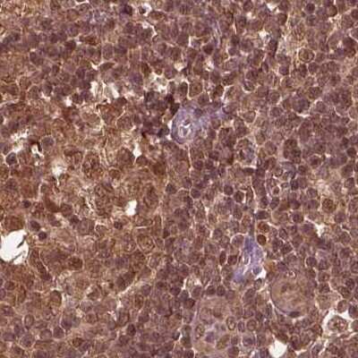 Immunohistochemistry-Paraffin: SUG1 Antibody [NBP2-57621]