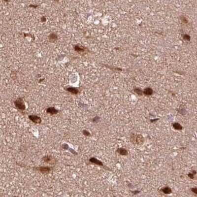 Immunohistochemistry-Paraffin: SUG1 Antibody [NBP2-57621]