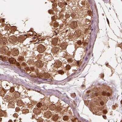 Immunohistochemistry-Paraffin: SUG1 Antibody [NBP2-57621]