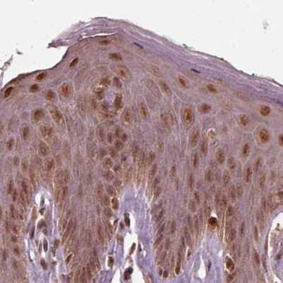 Immunohistochemistry-Paraffin: SUG1 Antibody [NBP2-57621]