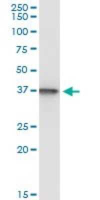 Immunoprecipitation: SUGT1 Antibody (1A10) [H00010910-M04]
