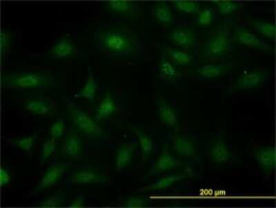 Immunocytochemistry/ Immunofluorescence: SUGT1 Antibody (6G5) [H00010910-M03]