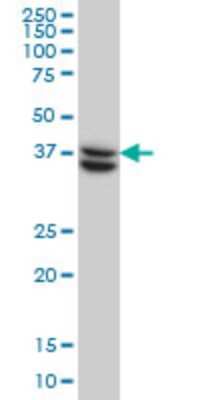 Western Blot: SUGT1 Antibody (6G5) [H00010910-M03]