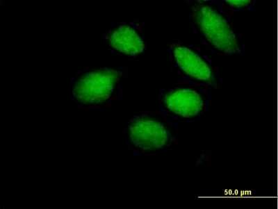 Immunocytochemistry/ Immunofluorescence: SUHW1 Antibody [H00129025-B01P]