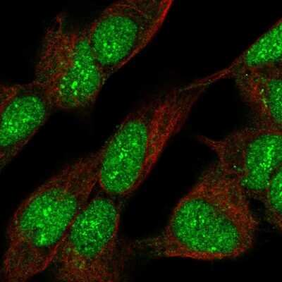Immunocytochemistry/ Immunofluorescence: SUHW3 Antibody [NBP2-33618]