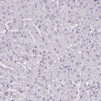 Immunohistochemistry-Paraffin: SUHW3 Antibody [NBP2-33618]