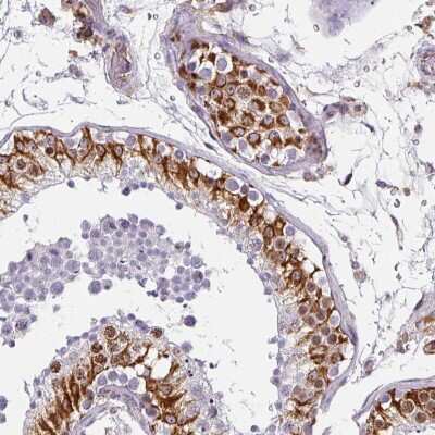 Immunohistochemistry-Paraffin: SUHW3 Antibody [NBP2-33618]