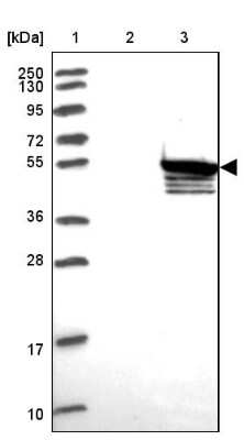 Western Blot: SUHW3 Antibody [NBP2-33618]