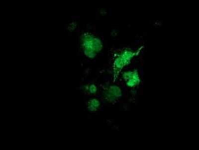 Immunocytochemistry/ Immunofluorescence: Cytosolic Sulfotransferase 1A1/SULT1A1 Antibody (OTI9B7) [NBP2-03227]