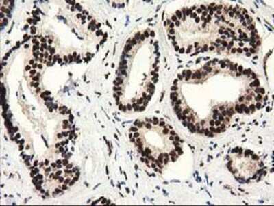 Immunohistochemistry-Paraffin: Cytosolic Sulfotransferase 1A1/SULT1A1 Antibody (OTI9B7) [NBP2-03227]