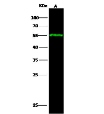 Western Blot: SULT1A3 Antibody [NBP2-99790]