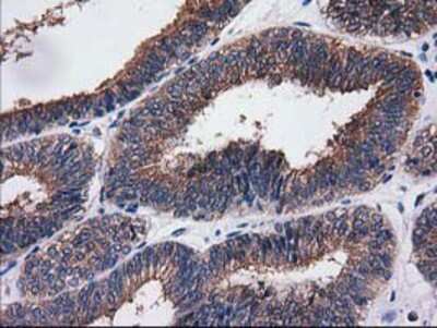 Immunohistochemistry-Paraffin: Cytosolic Sulfotransferase 1C2/SULT1C2 Antibody (OTI4G1) [NBP2-00486]