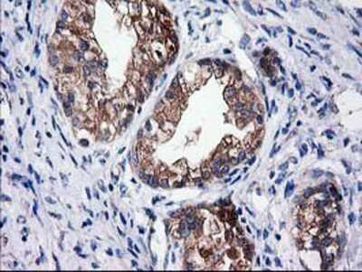 Immunohistochemistry-Paraffin: Cytosolic Sulfotransferase 1C2/SULT1C2 Antibody (OTI4G1) [NBP2-00486]