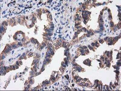 Immunohistochemistry-Paraffin: Cytosolic Sulfotransferase 1C2/SULT1C2 Antibody (OTI4G1) [NBP2-00486]