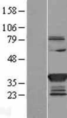Western Blot: Cytosolic Sulfotransferase 1C2/SULT1C2 Overexpression Lysate [NBL1-16605]