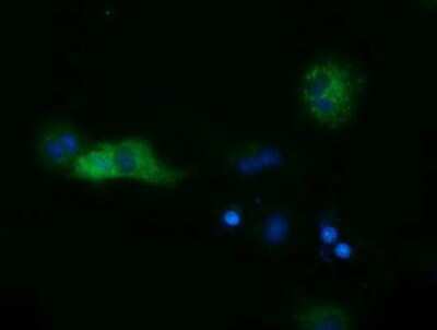 Immunocytochemistry/ Immunofluorescence: Cytosolic Sulfotransferase 2A1/SULT2A1 Antibody (OTI4D7) [NBP2-03003]