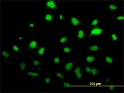 Immunocytochemistry/ Immunofluorescence: SUMO Activating Enzyme E1 (SAE1) Antibody (1G4-1G5) [H00010055-M01]
