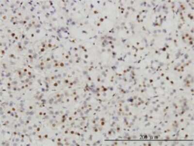 Immunohistochemistry-Paraffin: SUMO Activating Enzyme E1 (SAE1) Antibody (1G4-1G5) [H00010055-M01]