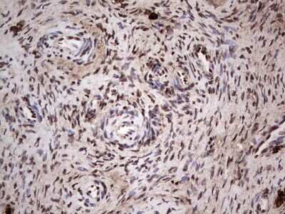 Immunohistochemistry: SUMO Activating Enzyme E1 (SAE1) Antibody (OTI6B11) [NBP2-45683]