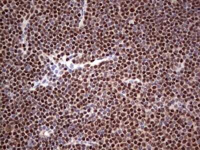 Immunohistochemistry: SUMO Activating Enzyme E1 (SAE1) Antibody (OTI6B11) [NBP2-45683]