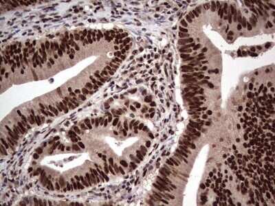Immunohistochemistry: SUMO Activating Enzyme E1 (SAE1) Antibody (OTI6B11) - Azide and BSA Free [NBP2-74410]