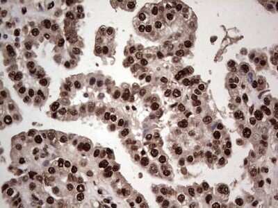 Immunohistochemistry: SUMO Activating Enzyme E1 (SAE1) Antibody (OTI6B11) - Azide and BSA Free [NBP2-74410]