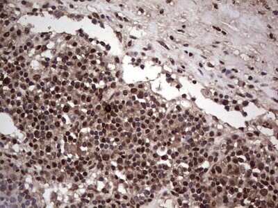 Immunohistochemistry: SUMO Activating Enzyme E1 (SAE1) Antibody (OTI6B11) - Azide and BSA Free [NBP2-74410]