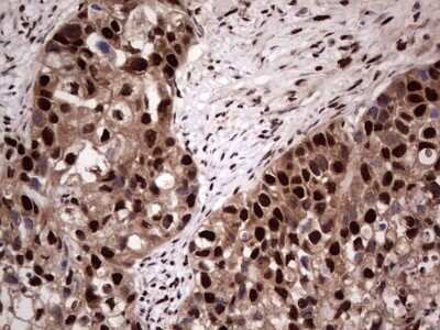 Immunohistochemistry: SUMO Activating Enzyme E1 (SAE1) Antibody (OTI6B11) - Azide and BSA Free [NBP2-74410]
