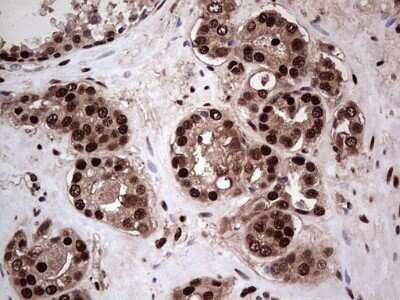 Immunohistochemistry: SUMO Activating Enzyme E1 (SAE1) Antibody (OTI6B11) - Azide and BSA Free [NBP2-74410]