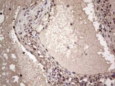 Immunohistochemistry: SUMO Activating Enzyme E1 (SAE1) Antibody (OTI6B11) - Azide and BSA Free [NBP2-74410]