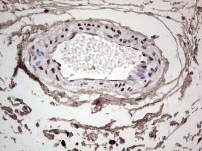 Immunohistochemistry: SUMO Activating Enzyme E1 (SAE1) Antibody (OTI6B11) - Azide and BSA Free [NBP2-74410]