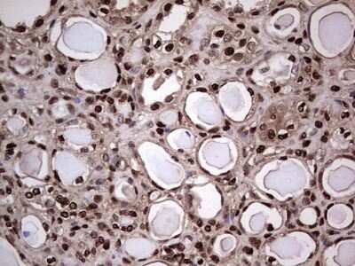 Immunohistochemistry: SUMO Activating Enzyme E1 (SAE1) Antibody (OTI6B11) - Azide and BSA Free [NBP2-74410]
