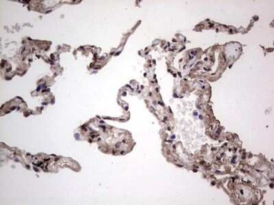 Immunohistochemistry: SUMO Activating Enzyme E1 (SAE1) Antibody (OTI6B11) - Azide and BSA Free [NBP2-74410]