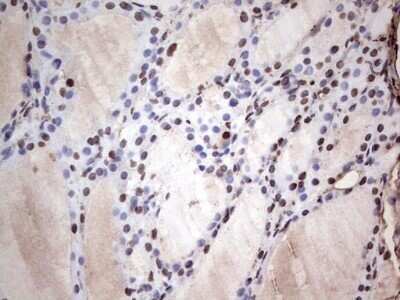 Immunohistochemistry: SUMO Activating Enzyme E1 (SAE1) Antibody (OTI6B11) - Azide and BSA Free [NBP2-74410]