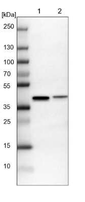 Western Blot: SUMO Activating Enzyme E1 (SAE1) Antibody [NBP2-13273]