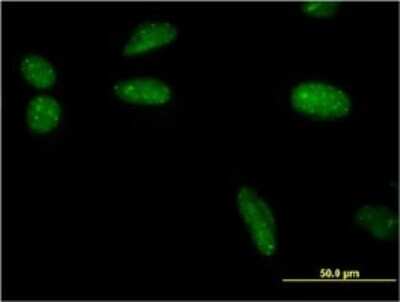 Immunocytochemistry/ Immunofluorescence: SUMO1 Antibody (3D7) [H00007341-M03]
