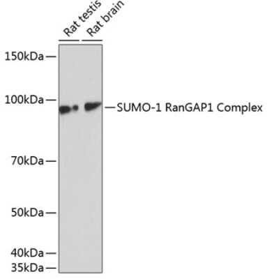 Western Blot: SUMO1 Antibody (6F8B6) [NBP3-15676]