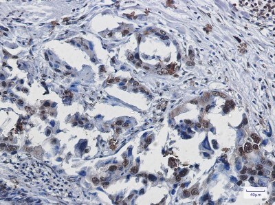 Immunohistochemistry-Paraffin: SUMO1 Antibody (S04-9G9) [NBP3-19782]