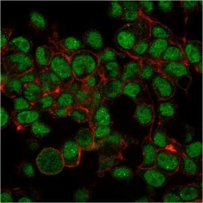 Immunocytochemistry/ Immunofluorescence: SUMO1 Antibody (SM1/495) - Azide and BSA Free [NBP2-34716]
