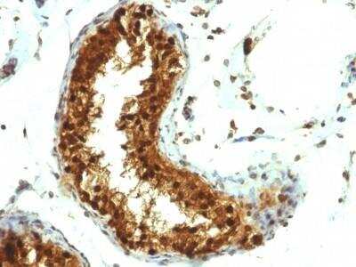Immunohistochemistry-Paraffin: SUMO1 Antibody (SUMO1/1188) - Azide and BSA Free [NBP2-47697]