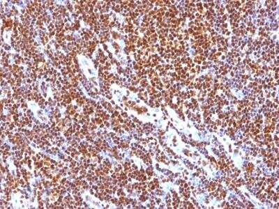 Immunohistochemistry-Paraffin: SUMO1 Antibody (SUMO1/1188) - IHC-Prediluted [NBP2-48449]